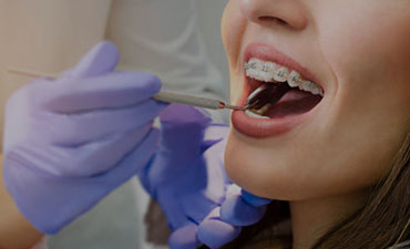 Badanie stomatologiczne Gabinet So! Smile Ortodoncja i stomatologia Kielce